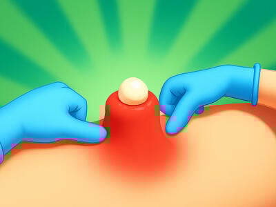 Pimple Squeeze oнлайн-игра
