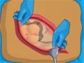 Operate Now: Appendix Surgery online game