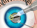 Operate Now: Eye Surgery - 🕹️ Online Game | Gameflare.com