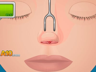 Operate Now: Nose Surgery online game