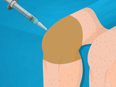 Operate Now: Knee Surgery online game