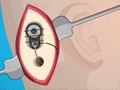 Operate Now: Ear Surgery online game
