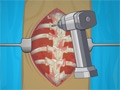Operate Now: Scoliosis Surgery online game
