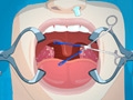 Operate Now: Tonsil Surgery online game