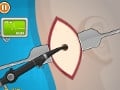 Operate Now: Eardrum Surgery online game