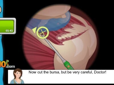 Operate Now: Shoulder Surgery online game