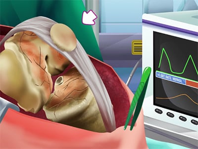 OPERATE NOW: PERICARDIUM SURGERY jogo online gratuito em Minijogos