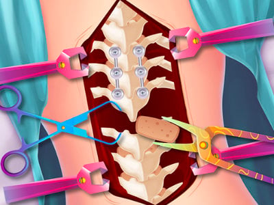 Anna Scoliosis Surgery online game